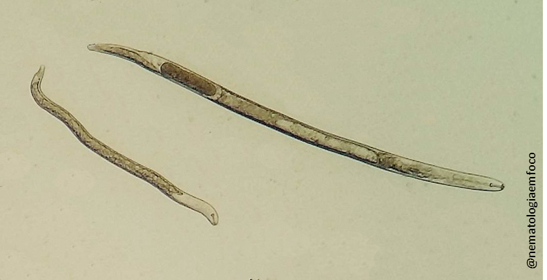 Imagem de microscópio de um Pratylenchus brachyurus. Um verme alongado, semelhante a uma lombriga. 